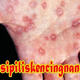Illustration for article titled Obat Sipilis Kencing nanah Cepat Sembuh 3 hari